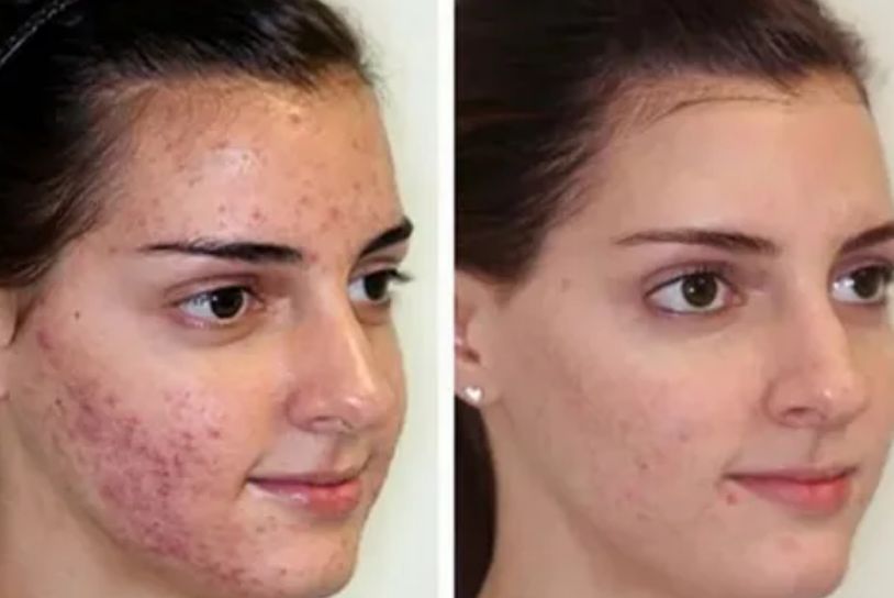 Before & After